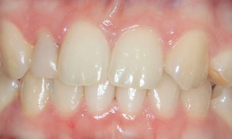 Cosmetic Dentistry Armidale